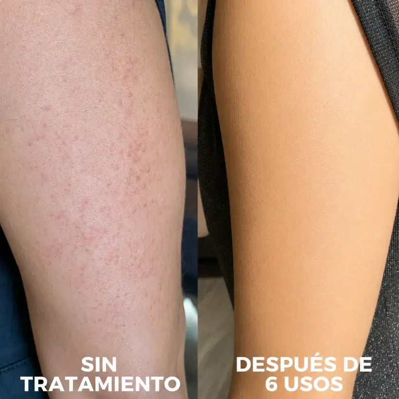 Te dijeron que "raspás"
