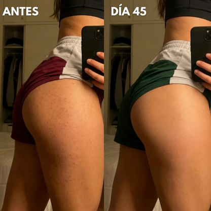 Resultado visual en glúteos y piernas: antes y día 45
